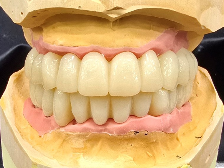 한솔치과기공소 작품 6